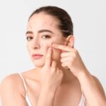 Lý do da bị breakout và giải pháp khắc phục hiệu quả Lý do da bị breakout và giải pháp khắc phục hiệu quả