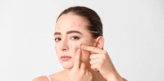 Lý do da bị breakout và giải pháp khắc phục hiệu quả Lý do da bị breakout và giải pháp khắc phục hiệu quả