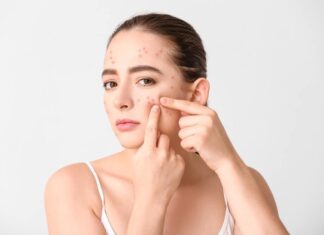 Lý do da bị breakout và giải pháp khắc phục hiệu quả Lý do da bị breakout và giải pháp khắc phục hiệu quả