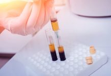 Trẻ Hóa Da Bằng PRP: Các Nàng Đã Nghe Qua? Trẻ Hóa Da Bằng PRP: Các Nàng Đã Nghe Qua?