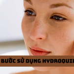 cac-buoc-su-dung-hydroquinone