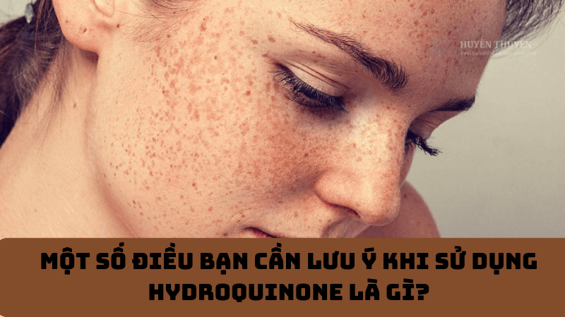 Một số điều bạn cần lưu ý khi sử dụng Hydroquinone là gì?