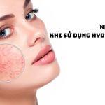 nhung-luu-y-khi-su-dung-hydroquinone