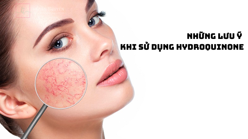 Những lưu ý khi sử dụng hydroquinone