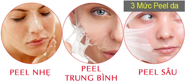 Tìm hiểu về phương pháp Peel da