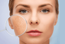 HƯỚNG DẪN THU NHỎ LỖ CHÂN LÔNG CHO NỀN DA DẦU Thu nhỏ lỗ chân lông