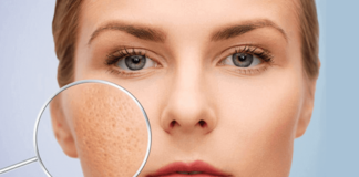 Thu nhỏ lỗ chân lông