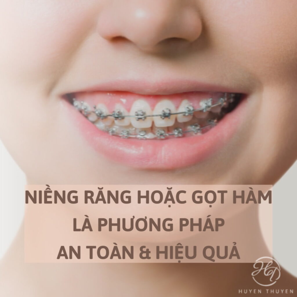 gọt hàm để thon gọn hàm