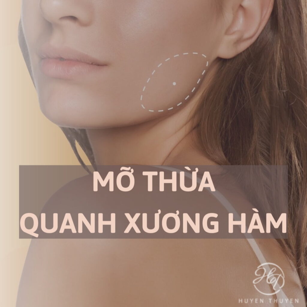 loại bỏ mỡ thừa để thon gọn hàm
