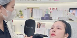 Tiêm filler an toàn và hiệu quả để tránh over filler