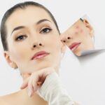Treatment cho nền da mỏng yếu liệu có ổn không?