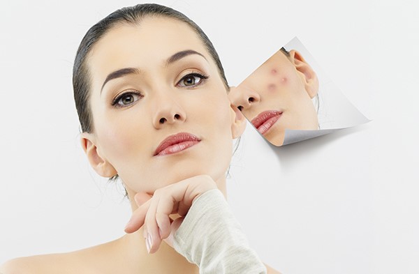 Treatment cho nền da mỏng yếu liệu có ổn không?