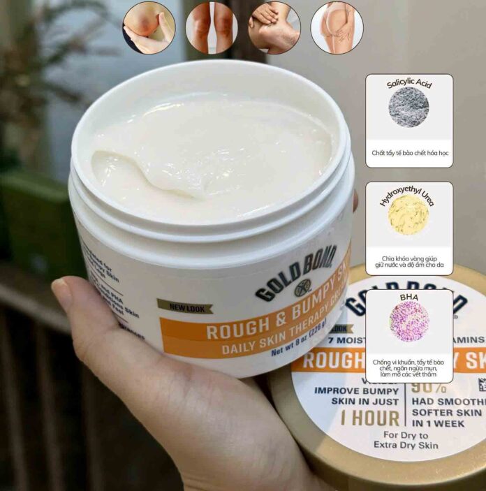 Review Kem Dưỡng Gold Bond: Có Thực Sự Hiệu Quả?