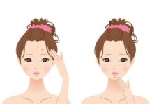 Kiểm soát dầu thừa: Giải pháp cho làn da mụn và sợi bã nhờn