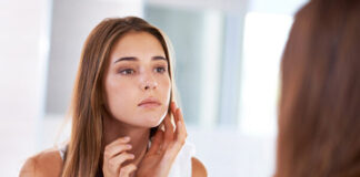 Da nàng bong tróc đỏ rát là bình thường hay bỏng peel?