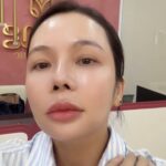 Peel da trắng sáng chỉ hai củ rưỡi tại Măng Skin Clinic có gì?