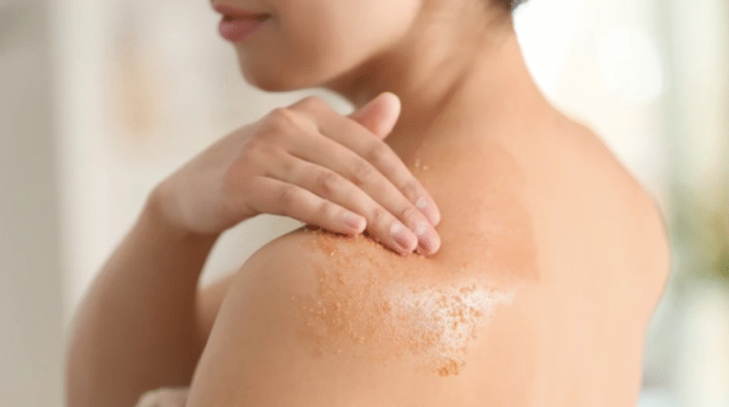 Mụn lưng nhiều quá: Giải pháp cho làn da mịn màng