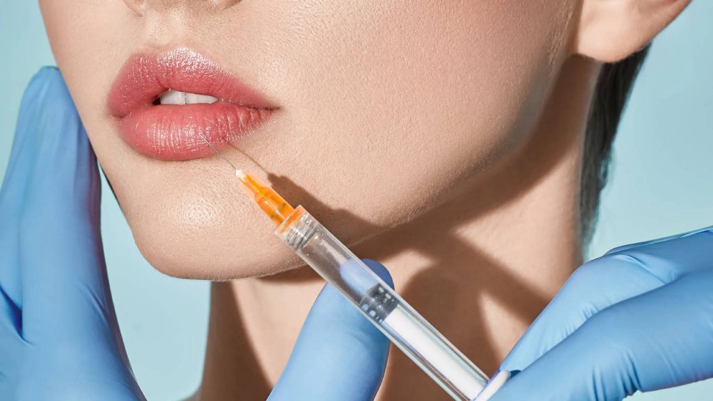 "Filler môi" Bí quyết cho đôi môi nàng quyến rũ tự nhiên