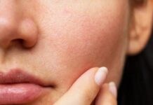 Tất tần tật lý do vì sao làm đủ mọi cách mà lỗ chân lông vẫn to?