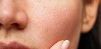 Tất tần tật lý do vì sao làm đủ mọi cách mà lỗ chân lông vẫn to?