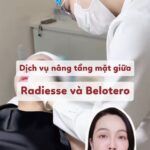 Nâng tầng mặt giữa bằng Radiesse và Belotero: Một tháng sau nhìn lại