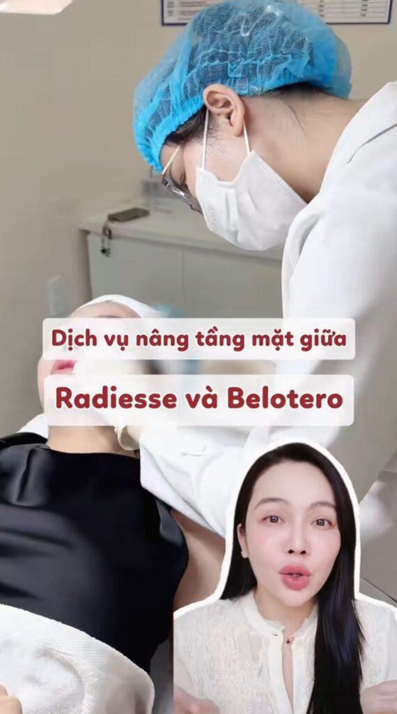 Nâng tầng mặt giữa bằng Radiesse và Belotero: Một tháng sau nhìn lại