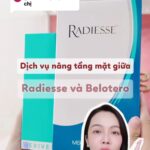 Nâng tầng mặt giữa bằng Radiesse và Belotero: Một tháng sau nhìn lại