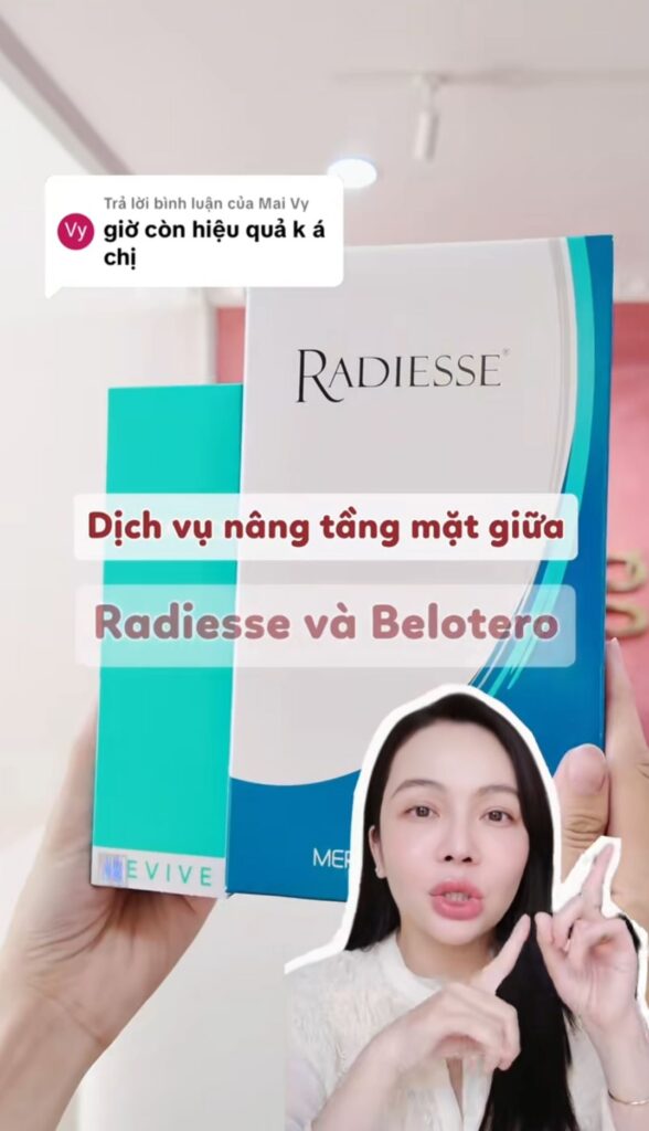 Nâng tầng mặt giữa bằng Radiesse và Belotero: Một tháng sau nhìn lại