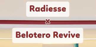 Nâng tầng mặt giữa bằng Radiesse và Belotero: Một tháng sau nhìn lại