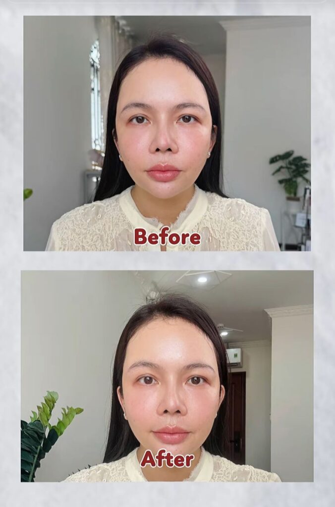 2 tuần trải nghiệm máy nâng cơ Gemo 25 củ, kết quả là...