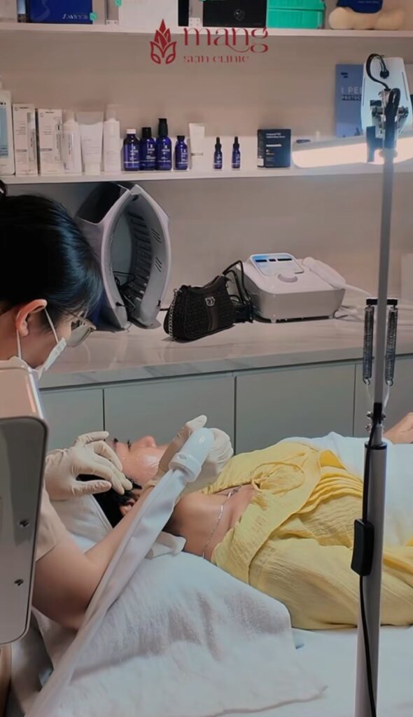 Top 6 cách trị nám da hiệu quả nhất hiện nay