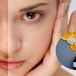 Da kích ứng vitamin C và hành trình phục hồi sau tổn thương