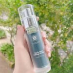Ưu nhược điểm 4 em dưỡng trắng cải thiện sắc tố hot nhất hiện nay