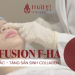 Top 3 dòng Meso “must try” tại Măng Skin Clinic