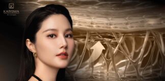 Karisma và Radiesse dẫn đầu xu hướng tăng sinh tự thân