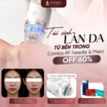 Chấm điểm các phương pháp làm đẹp, trẻ hoá phổ biến nhất hiện nay