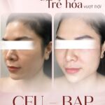 Chấm điểm các phương pháp làm đẹp, trẻ hoá phổ biến nhất hiện nay