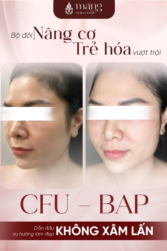 Chấm điểm các phương pháp làm đẹp, trẻ hoá phổ biến nhất hiện nay