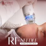 RF Needle và bí mật tái sinh làn da căng bóng, trẻ trung của mình!