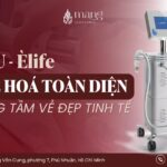 Phương pháp CFU có thể làm tan Filler không? CFU có làm tan Filler không?