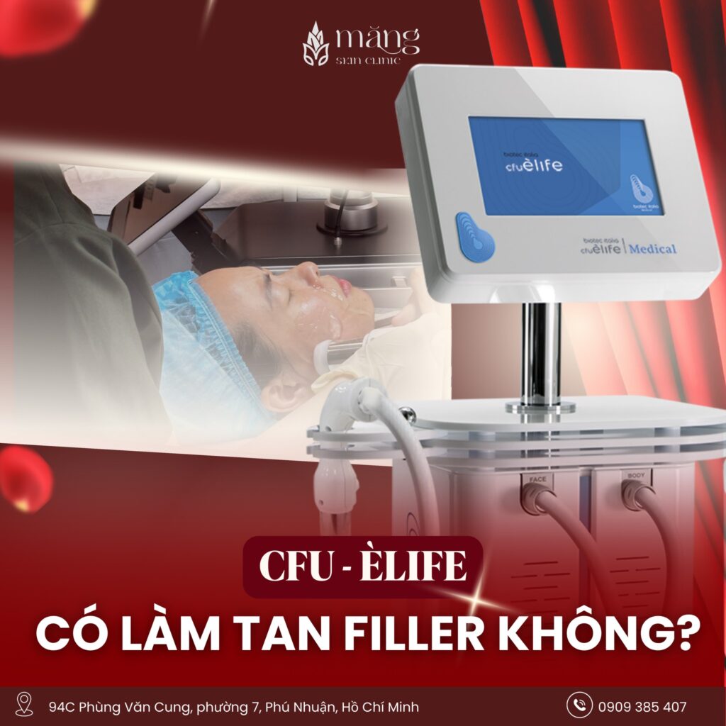 CFU có làm tan Filler không?