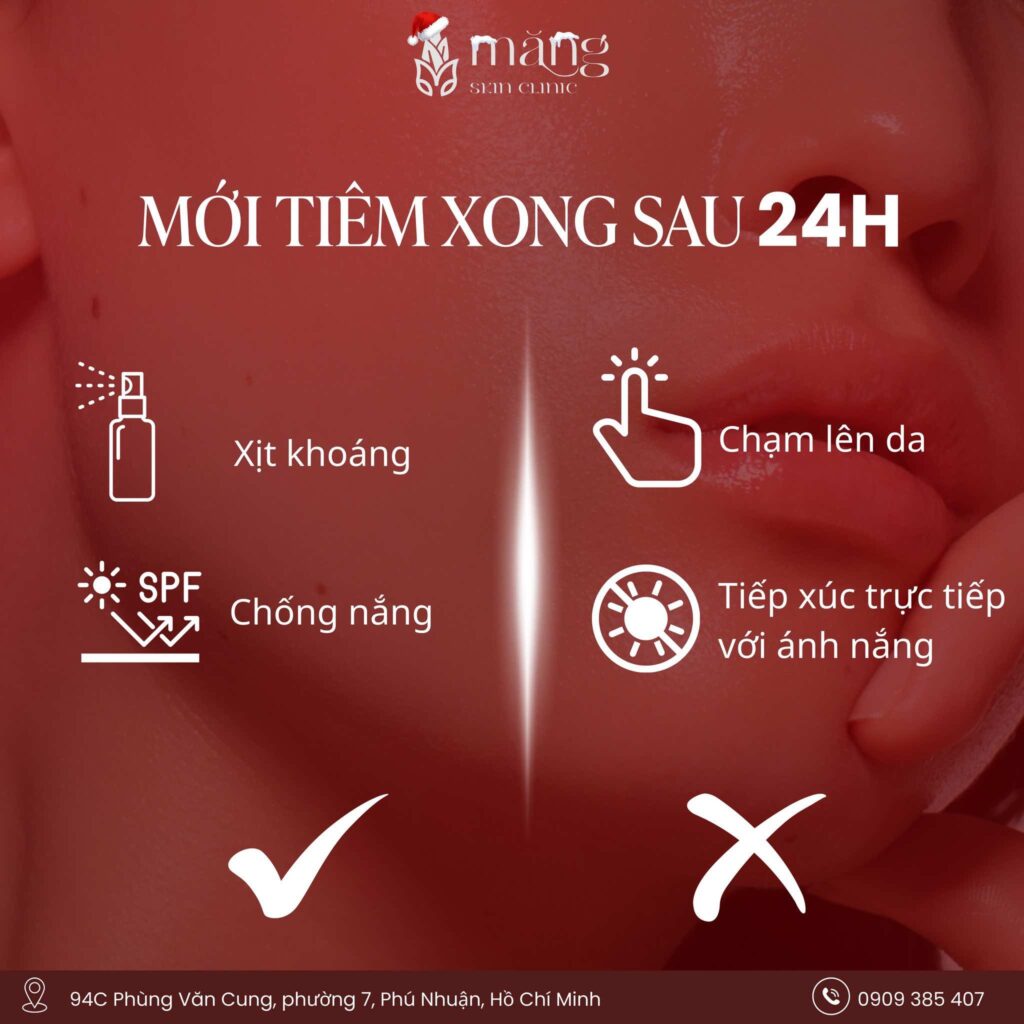 Sau khi tiêm Mesotherapy nên dưỡng da thế nào mới chuẩn?