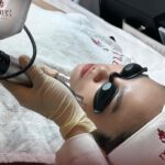 Trẻ hoá da bằng RF tại Măng Skin Clinic có gì hot? Trẻ hoá da bằng RF tại Măng Skin Clinic có gì hot?