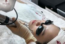 Trẻ hoá da bằng RF tại Măng Skin Clinic có gì hot? Trẻ hoá da bằng RF tại Măng Skin Clinic có gì hot?