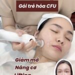 Vì sao Măng lại ưu tiên tư vấn CFU thay vì tiêm filler, botox?