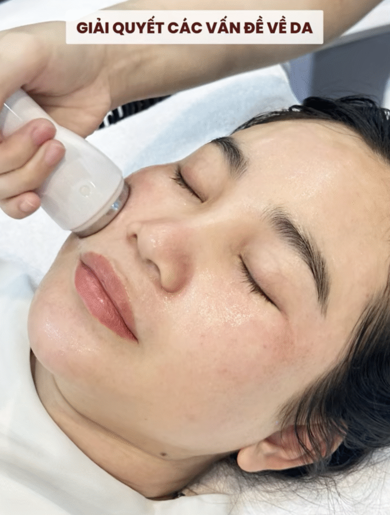 Top 3 dòng Meso "must try" tại Măng Skin Clinic