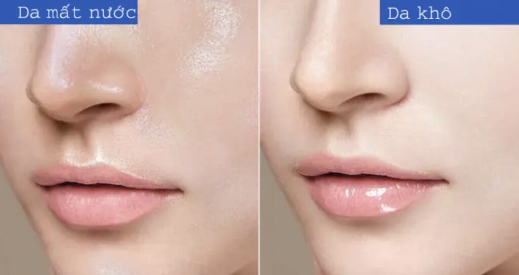 Da thiếu nước và da khô các nàng đã biết cách phân biệt?