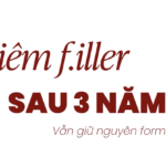 Tiêm Filler sau 3 năm vẫn y nguyên cẩn thận bom nổ chậm