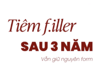 Tiêm Filler sau 3 năm vẫn y nguyên cẩn thận bom nổ chậm