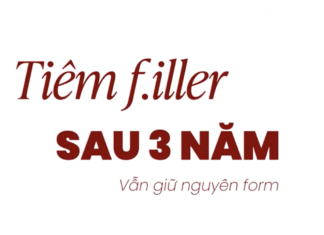 Tiêm Filler sau 3 năm vẫn y nguyên cẩn thận bom nổ chậm